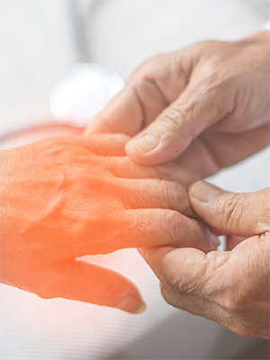What is Hand Numbness a Symptom of?